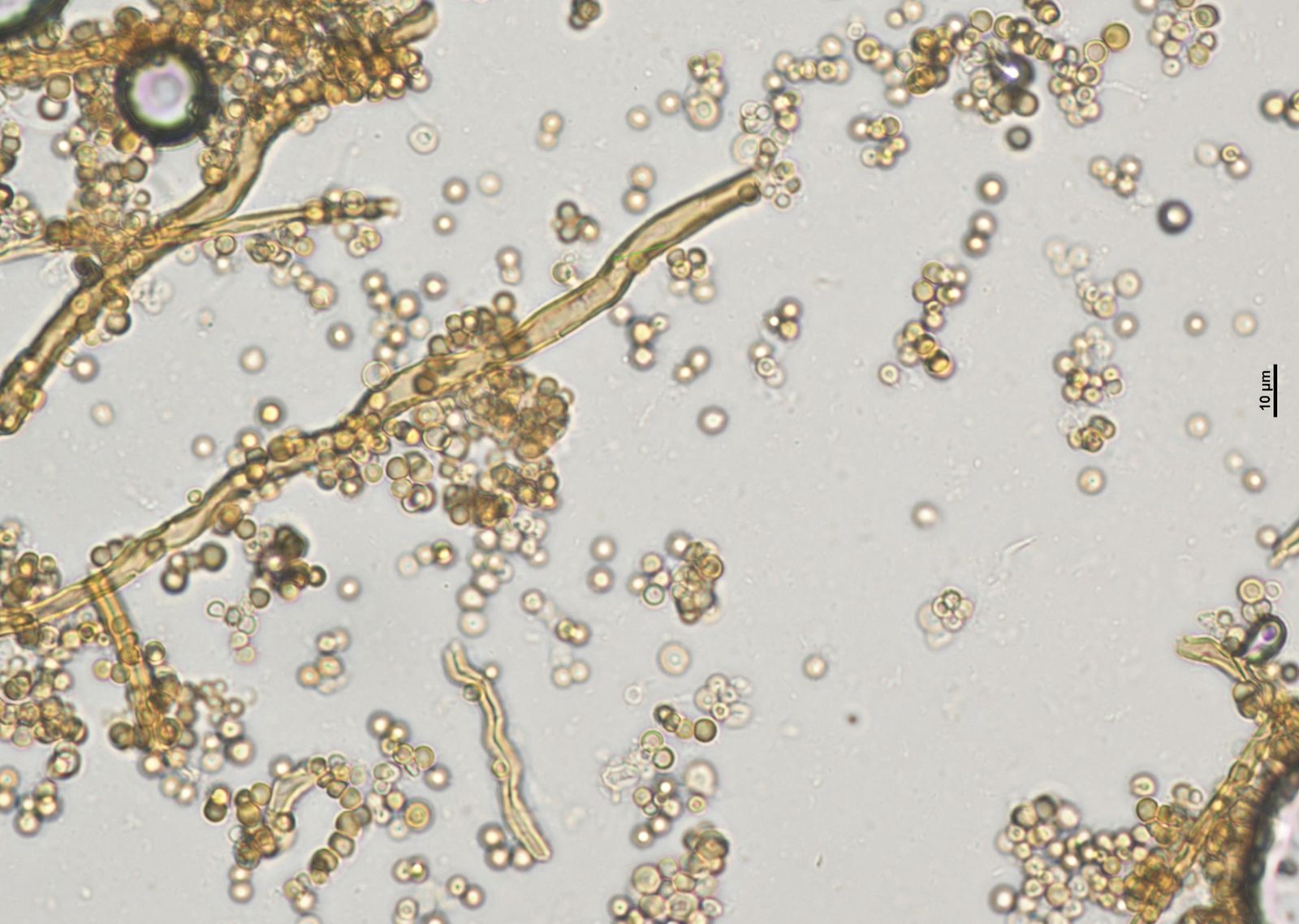 Lycoperdon utriforme